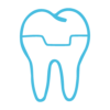 Prótesis | Dentista Madrid · Instituto Dental Dr. Carreño